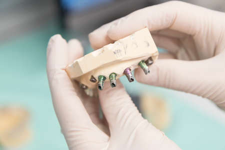 Close up detail of dentist tools for healthcare and surgery.の写真素材