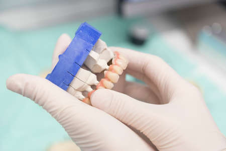 Close up detail of dentist tools for healthcare and surgery.の写真素材