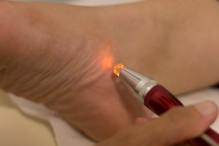 Close up of a woman using a lancet pen to burn her legの写真素材