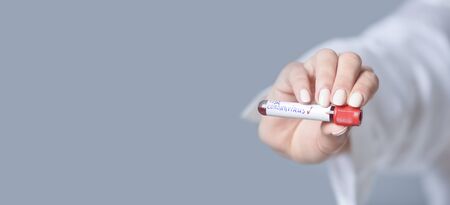 Nurse holding a positive blood test result for the new rapidly spreading Coronavirusの写真素材