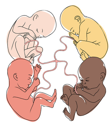 Four babies with the different color of skin are connected by one umbilical cordのイラスト素材