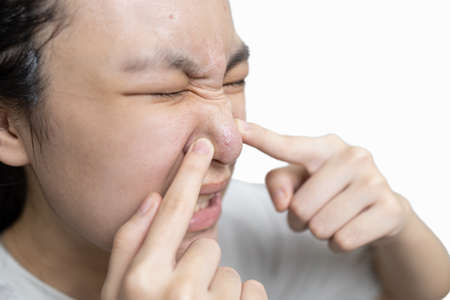 Asian teenager girl squeezing pimples,problem of inflammation acne on face,lady woman with a painful facial expression while popping a pimple,acne spots or blackhead on her nose, skin care conceptの写真素材