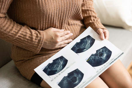 Hand of woman holding ultrasound image test report from the examination,female has a stomachache,check about abdominal pain or uterus disease,uterine cysts or pregnancy problems or cancer,health careの写真素材