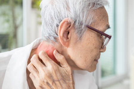 Senior woman scratching her neck,itchy skin,dry skin,Atopic Dermatitis,elderly have an allergic reaction to sweat from hot weather,sweat heat,red rash on her neck or urticaria,itching and irritationの写真素材