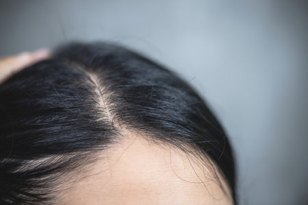 A woman worried about hair loss for health care shampoo and beauty product ideas.の写真素材