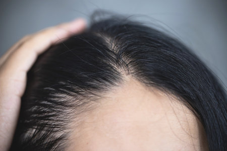 Close-up women worried about severe hair loss Thin baldness and damaged scalp and hair Health care conceptの写真素材