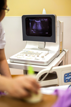 ultrasound medical device monitor with image of heartの写真素材