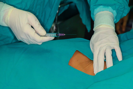 Anesthesia  injections preoperative