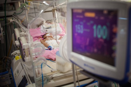 Monitor children in the incubatorsの写真素材