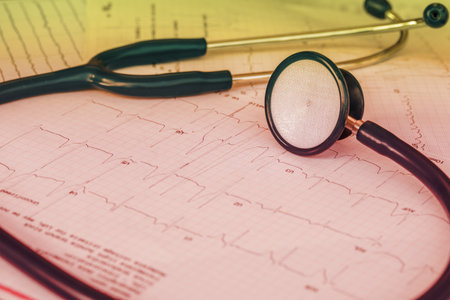 Cardiogram with stethoscope .の写真素材