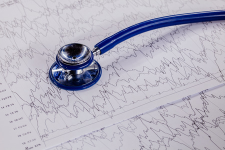 Stethoscope on EEG sheetの写真素材
