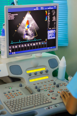 Echocardiogram to patient in hospitalの写真素材