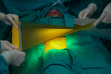 Surgeon with patient during surgery to treatment in operating room.の写真素材