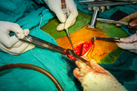 Patient during surgery to jaw bone treatment in operating room at hospital.