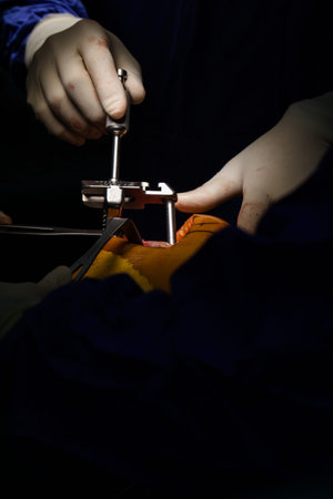 Team of doctor working at operating room in hospital. Surgeon perform total knee replacement...