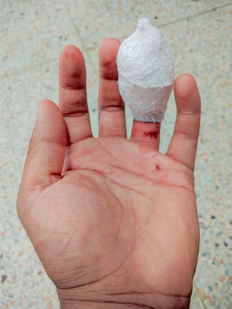 Finger woundの写真素材