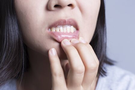 Young Woman is Having Toothacheの写真素材