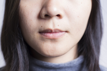 Mouth and Moleの写真素材