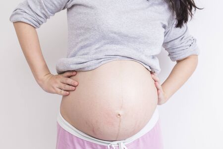 Pregnant woman has backache and touching her torsoの写真素材