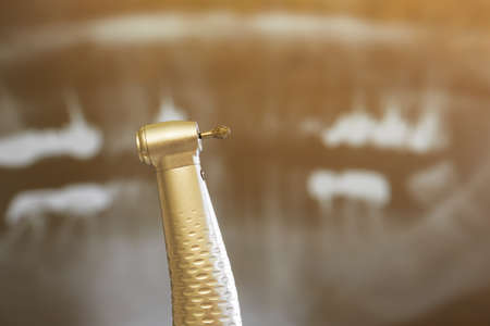 Macro view on dentist drillの写真素材