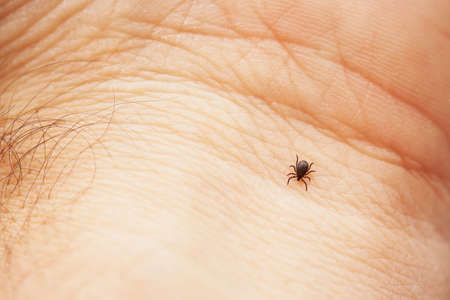 Tick is crawling on the human palmの写真素材