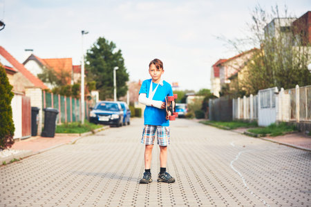 Mischievous boy with broken hand injured after accident on skateboard.の写真素材