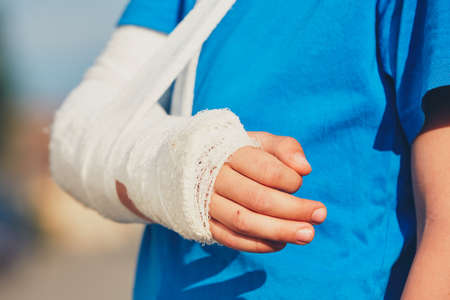 Broken hand of the little boy injured after accidentの写真素材