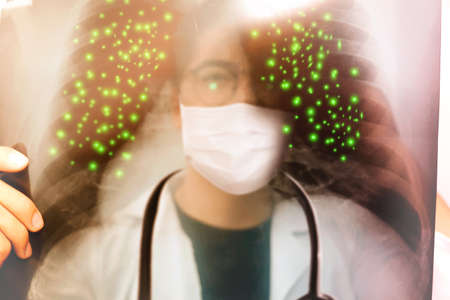 Covid-19 Concept : Blur image The male doctor examined the chest X-ray film of patients with Corona virus( Covid-19 )and found the spread of the respiratory tract : Blurred backgroundの写真素材