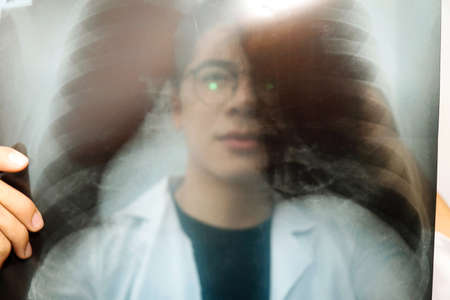 Doctor, lung specialist, X-ray film analysis of patients with respiratory problems in the hospital
