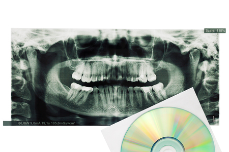 X-ray printed photo of teeth and digital disk. Isolated on white.