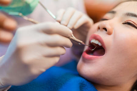 Closeup woman having dental teeth examined dentist check-up via excavator in Clinic her patient for beautiful smileの写真素材