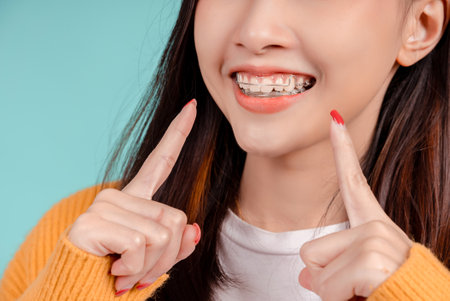 Dental Beautiful smiling of young asian woman with retainer braces glad emotion with white teeth increase confidence for healthy on blue background isolated, Happiness teenager facial expression.の写真素材
