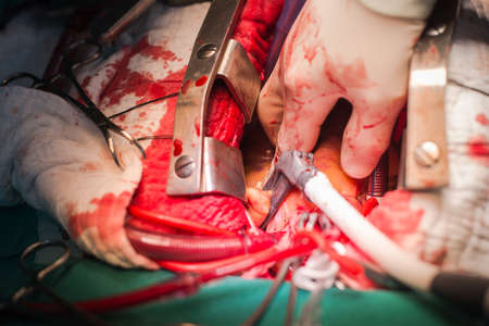 use bipolar to make mazeの写真素材