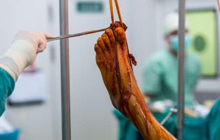 Scrub nurse use cleaning solution paint all foot and leg prepareの写真素材
