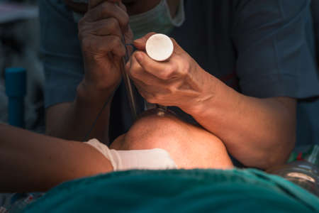 Insertion endotracheal tubeの写真素材