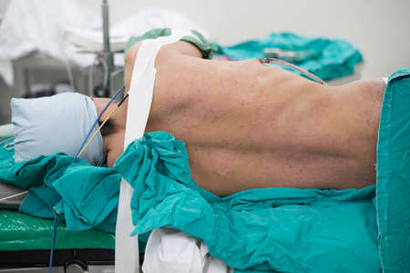 Scrub nurse scrub patient prepare for chest operation