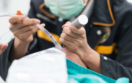 Intubate endotracheal tubeの写真素材