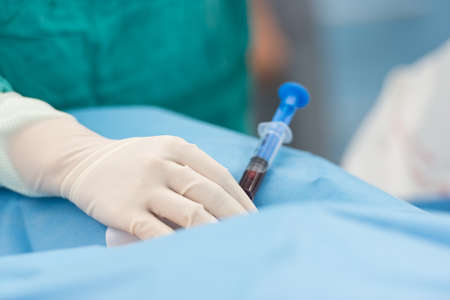 puncture internal carotid veinの写真素材