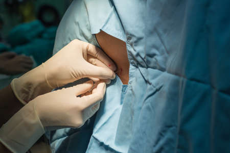 spinal block