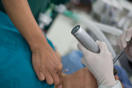 insert endotracheal tubeの写真素材