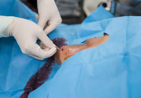 doctor apply bladeの写真素材