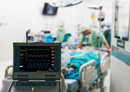 iabp used after open heart surgeryの写真素材