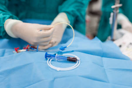 central venous pressure procedure