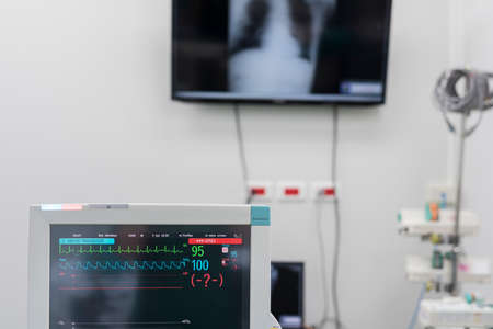 monitor equipments in surgery roomの写真素材