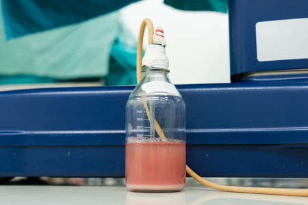 chest drainの写真素材