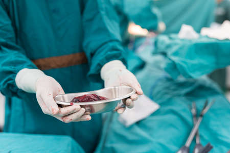 show specimen after surgeryの写真素材