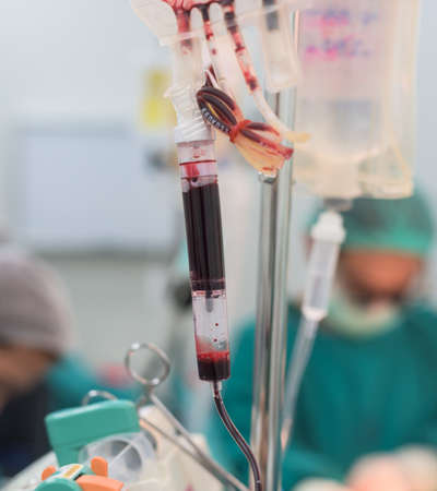 giving blood component during operationの写真素材