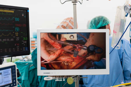 medical monitorの写真素材