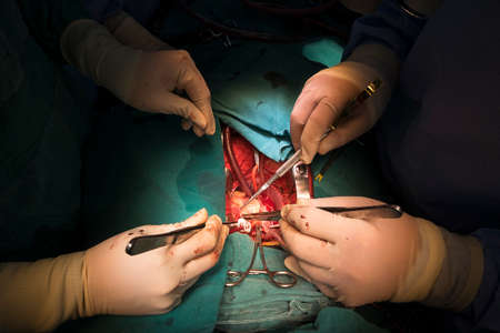 total correction tetalogy of follotの写真素材