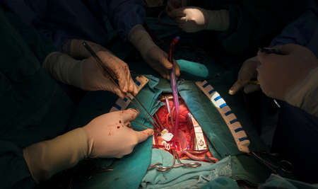 total correction tetalogy of follot